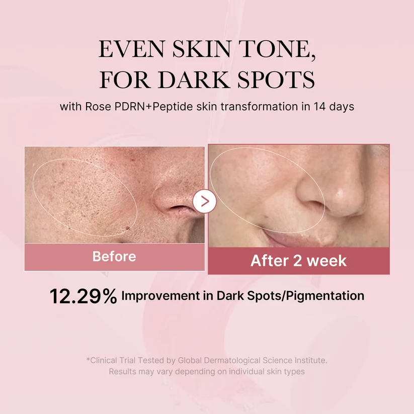 Medicube - Pdrn Pink Cica Soothing Toner 250ml Before After result