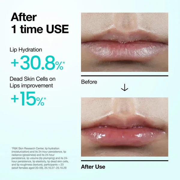 Anua PDRN Hyaluronic Acid Lip Serum 10ml 2 Clinical hydration and texturing results on dry chapped lips after one time use of Anua PDRN Lip Serum.
